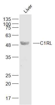 Mouse liver lysates probed with C1RL Polyclonal Antibody, Unconjugated (bs-15087R) at 1:500 dilution and 4˚C overnight incubation. Followed by conjugated secondary antibody incubation at 1:10000 for 60 min at 37˚C.