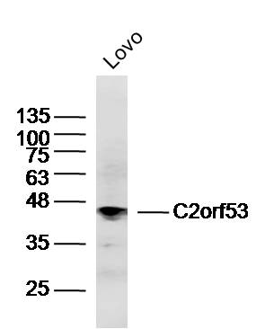 Lovo lysates probed with C2orf53 Polyclonal Antibody, Unconjugated (bs-15152R) at 1:300 dilution and 4˚C overnight incubation. Followed by conjugated secondary antibody incubation at 1:10000 for 60 min at 37˚C.