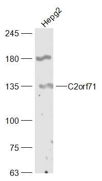 HepG2 lysates probed with C2orf71 Polyclonal Antibody, Unconjugated (bs-15158R) at 1:300 dilution and 4˚C overnight incubation. Followed by conjugated secondary antibody incubation at 1:10000 for 60 min at 37˚C.
