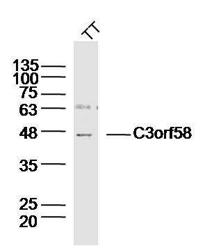 Human TT lysates probed with C3orf58 Polyclonal Antibody, Unconjugated (bs-15179R) at 1:300 dilution and 4˚C overnight incubation. Followed by conjugated secondary antibody incubation at 1:10000 for 60 min at 37˚C.