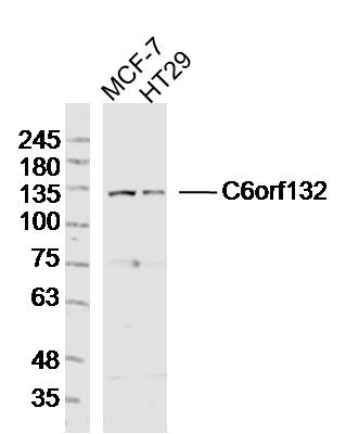 Lane 1: MCF-7 lysates; Lane 2: HT29 lysates probed with C6orf132 Polyclonal Antibody, Unconjugated (bs-15218R) at 1:300 dilution and 4˚C overnight incubation. Followed by conjugated secondary antibody incubation at 1:10000 for 60 min at 37˚C.