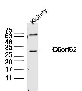 Mouse kidney lysates probed with C6orf62 Polyclonal Antibody, Unconjugated (bs-15251R) at 1:300 dilution and 4˚C overnight incubation. Followed by conjugated secondary antibody incubation at 1:10000 for 60 min at 37˚C.