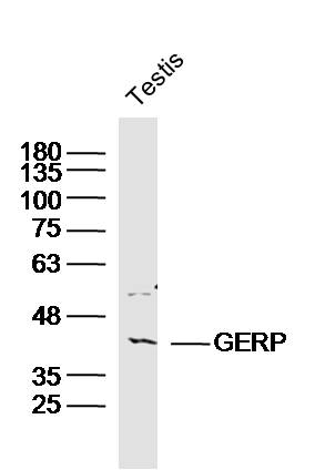 Mouse testis lysates probed with GPS2 Polyclonal Antibody, Unconjugated (bs-15395R) at 1:300 dilution and 4˚C overnight incubation. Followed by conjugated secondary antibody incubation at 1:10000 for 60 min at 37˚C.