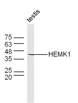 Mouse testis lysates probed with HEMK1 Polyclonal Antibody, Unconjugated (bs-15452R) at 1:300 dilution and 4˚C overnight incubation. Followed by conjugated secondary antibody incubation at 1:10000 for 60 min at 37˚C.