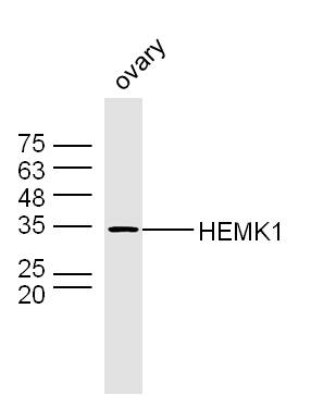 Mouse ovary lysates probed with HEMK1 Polyclonal Antibody, Unconjugated (bs-15452R) at 1:300 dilution and 4˚C overnight incubation. Followed by conjugated secondary antibody incubation at 1:10000 for 60 min at 37˚C.