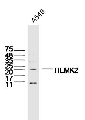 A549 lysates probed with HEMK2 Polyclonal Antibody, Unconjugated (bs-15453R) at 1:300 dilution and 4˚C overnight incubation. Followed by conjugated secondary antibody incubation at 1:10000 for 60 min at 37˚C.