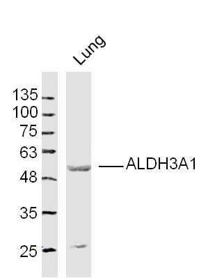 Mouse lung lysates probed with ALDH3A1 Polyclonal Antibody, Unconjugated (bs-15496R) at 1:300 dilution and 4˚C overnight incubation. Followed by conjugated secondary antibody incubation at 1:10000 for 60 min at 37˚C.