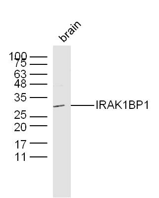 Mouse brain lysates probed with IRAK1BP1 Polyclonal Antibody, Unconjugated (bs-16694R) at 1:300 dilution and 4˚C overnight incubation. Followed by conjugated secondary antibody incubation at 1:10000 for 60 min at 37˚C.