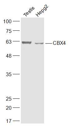 Lane 1: Mouse testis lysates; Lane 2: Human HepG2 lysates probed with CBX4 Polyclonal Antibody, Unconjugated (bs-17376R) at 1:300 dilution and 4˚C overnight incubation. Followed by conjugated secondary antibody incubation at 1:10000 for 60 min at 37˚C.
