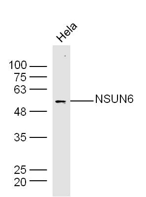 Hela lysates probed with NSUN6 Polyclonal Antibody, Unconjugated (bs-19484R) at 1:300 dilution and 4˚C overnight incubation. Followed by conjugated secondary antibody incubation at 1:10000 for 60 min at 37˚C.