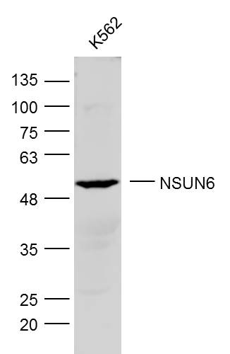 K562 lysates probed with NSUN6 Polyclonal Antibody, Unconjugated (bs-19484R) at 1:300 dilution and 4˚C overnight incubation. Followed by conjugated secondary antibody incubation at 1:10000 for 60 min at 37˚C.