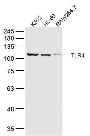 Lane 1: K562 lysates; Lane 2: HL-60 lysates; Lane 3: RAW264.7 lysates probed with TLR4 Polyclonal Antibody, Unconjugated (bs-20594R) at 1:2000 dilution and 4˚C overnight incubation. Followed by conjugated secondary antibody incubation at 1:10000 for 60 min at 37˚C.
