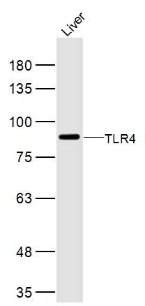 Mouse Liver lysates probed with TLR4 Polyclonal Antibody, Unconjugated (bs-20595R) at 1:300 dilution and 4˚C overnight incubation. Followed by conjugated secondary antibody incubation at 1:10000 for 60 min at 37˚C.