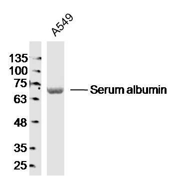 A549 lysates probed with Serum albumin Polyclonal Antibody, Unconjugated (bsm-0945M) at 1:300 dilution and 4˚C overnight incubation. Followed by conjugated secondary antibody incubation at 1:10000 for 60 min at 37˚C.