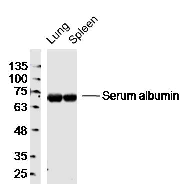 Lane 1: Mouse Lung lysates; Lane 2: Mouse Spleen lysates probed with Serum albumin Polyclonal Antibody, Unconjugated (bsm-0945M) at 1:300 dilution and 4˚C overnight incubation. Followed by conjugated secondary antibody incubation at 1:10000 for 60 min at 37˚C.