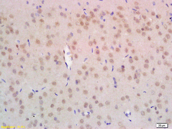 Formalin-fixed and paraffin embedded rat brain labeled with Anti-NPD014 Polyclonal Antibody, Unconjugated (bs-6441R) at 1:200 followed by conjugation to the secondary antibody and DAB staining.