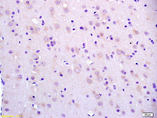 Formalin-fixed and paraffin embedded rat brain labeled with Anti-BCAT2/BCAM Polyclonal Antibody, Unconjugated (bs-6589R) at 1:200 followed by conjugation to the secondary antibody and DAB staining.