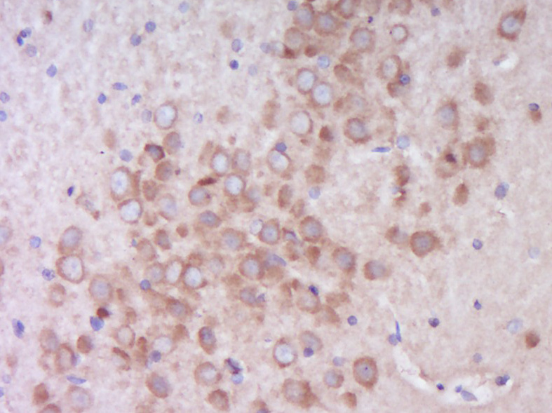 Paraformaldehyde-fixed, paraffin embedded Rat brain; Antigen retrieval by boiling in sodium citrate buffer (pH6.0) for 15min; Block endogenous peroxidase by 3% hydrogen peroxide for 20 minutes; Blocking buffer (normal goat serum) at 37°C for 30min; Antibody incubation with EIF4B (Ser406) Polyclonal Antibody, Unconjugated (bs-14551R) at 1:400 overnight at 4°C, DAB staining.
