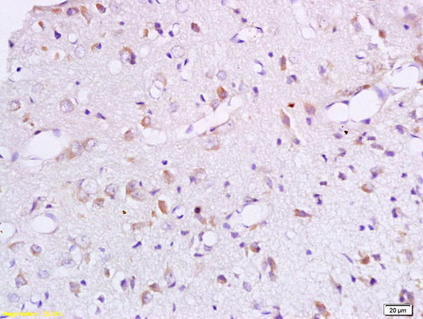 Formalin-fixed and paraffin embedded rat brain labeled with Anti-BCAT1 Polyclonal Antibody, Unconjugated (bs-6613R) at 1:200 followed by conjugation to the secondary antibody and DAB staining.