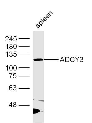 Mouse spleen lysates probed with ADCY3 Polyclonal Antibody, Unconjugated (bs-20272R) at 1:300 dilution and 4˚C overnight incubation. Followed by conjugated secondary antibody incubation at 1:10000 for 60 min at 37˚C.