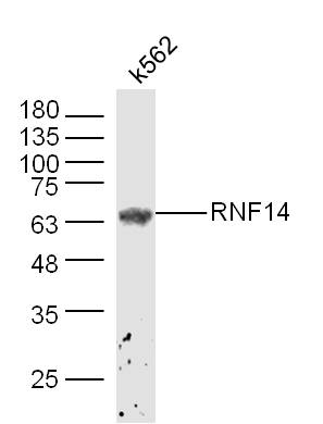 K562 lysates probed with ADAM2 Polyclonal Antibody, Unconjugated (bs-20273R) at 1:300 dilution and 4˚C overnight incubation. Followed by conjugated secondary antibody incubation at 1:10000 for 60 min at 37˚C.