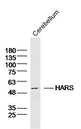 Mouse cerebellum lysates probed with HARS Polyclonal Antibody, Unconjugated (bs-20281R) at 1:300 dilution and 4˚C overnight incubation. Followed by conjugated secondary antibody incubation at 1:10000 for 60 min at 37˚C.