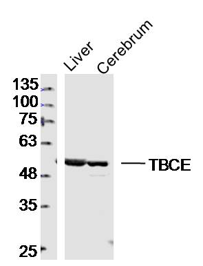 Lane 1: mouse iver lysates; Lane 2: mouse cererum lysates probed with TBCE Polyclonal Antibody, Unconjugated (bs-20328R) at 1:300 dilution and 4˚C overnight incubation. Followed by conjugated secondary antibody incubation at 1:10000 for 60 min at 37˚C.