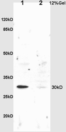 L1 rat liver lysates L2 rat brain lysates probed with Anti NQO1 Polyclonal Antibody, Unconjugated (bs-2184R) at 1:200 overnight at 4˚C. Followed by conjugation to secondary antibody (bs-0295G-HRP) at 1:3000 for 90 min at 37˚C. Predicted band 30kD. Observed band size:30kD.\n