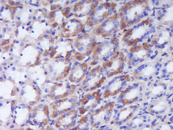 Paraformaldehyde-fixed, paraffin embedded Rat stomach; Antigen retrieval by boiling in sodium citrate buffer (pH6.0) for 15min; Block endogenous peroxidase by 3% hydrogen peroxide for 20 minutes; Blocking buffer (normal goat serum) at 37°C for 30min; Antibody incubation with MEK3/MAP2K3 Polyclonal Antibody, Unconjugated (bs-1689R) at 1:400 overnight at 4°C, DAB staining.