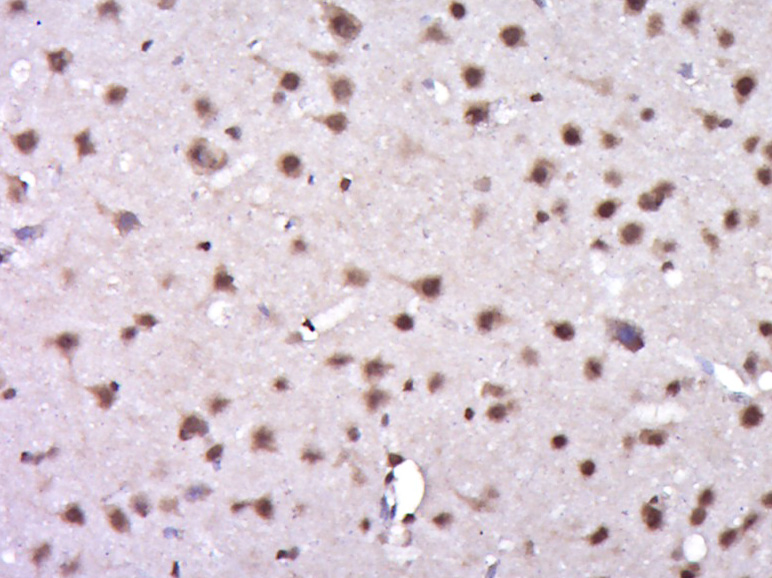 Paraformaldehyde-fixed, paraffin embedded Rat brain; Antigen retrieval by boiling in sodium citrate buffer (pH6.0) for 15min; Block endogenous peroxidase by 3% hydrogen peroxide for 20 minutes; Blocking buffer (normal goat serum) at 37°C for 30min; Antibody incubation with KAT5 (Ser86) Polyclonal Antibody, Unconjugated (bs-17096R) at 1:400 overnight at 4°C, DAB staining.