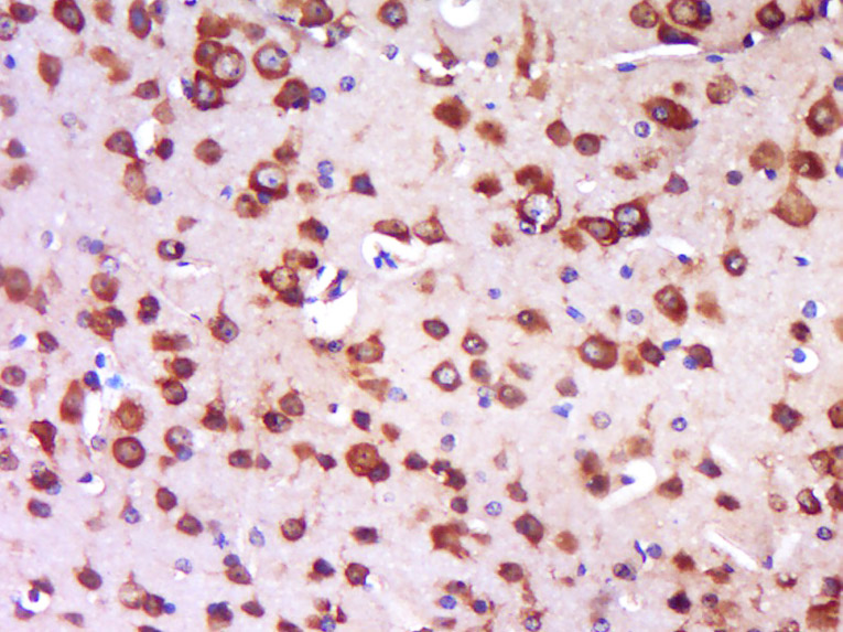 Paraformaldehyde-fixed, paraffin embedded Mouse brain; Antigen retrieval by boiling in sodium citrate buffer (pH6.0) for 15min; Block endogenous peroxidase by 3% hydrogen peroxide for 20 minutes; Blocking buffer (normal goat serum) at 37°C for 30min; Antibody incubation with TRIT1 Polyclonal Antibody, Unconjugated (bs-17134R) at 1:400 overnight at 4°C, DAB staining.