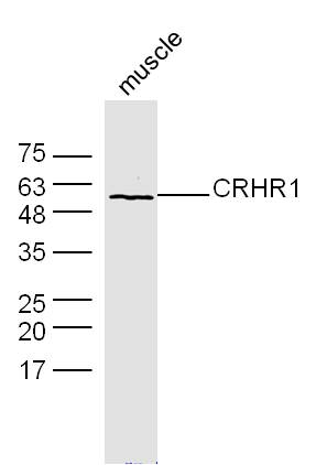 Mouse muscle lysates probed with CRHR1 Polyclonal Antibody, Unconjugated (bs-10248R) at 1:300 dilution and 4˚C overnight incubation. Followed by conjugated secondary antibody incubation at 1:10000 for 60 min at 37˚C.
