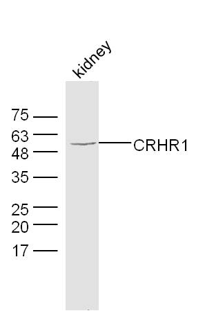 Mouse kidney lysates probed with CRHR1 Polyclonal Antibody, Unconjugated (bs-10248R) at 1:300 dilution and 4˚C overnight incubation. Followed by conjugated secondary antibody incubation at 1:10000 for 60 min at 37˚C. Mouse kidney lysates probed with CRHR1 Polyclonal Antibody, Unconjugated (bs-10248R) at 1:300 dilution and 4˚C overnight incubation. Followed by conjugated secondary antibody incubation at 1:10000 for 60 min at 37˚C.
