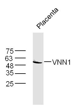 Mouse placenta lysates probed with VNN1 Polyclonal Antibody, Unconjugated (bs-10314R) at 1:300 dilution and 4˚C overnight incubation. Followed by conjugated secondary antibody incubation at 1:10000 for 60 min at 37˚C.