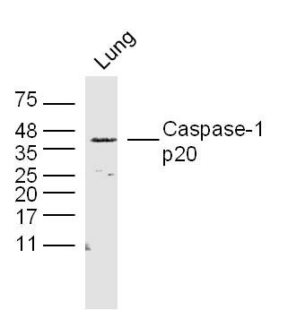 Rat lung lysates probed with Caspase-1 p20 Polyclonal Antibody, Unconjugated (bs-10442R) at 1:300 dilution and 4˚C overnight incubation. Followed by conjugated secondary antibody incubation at 1:10000 for 60 min at 37˚C.