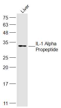 Rat liver lysates probed with IL-1 Alpha Polyclonal Antibody, Unconjugated (bs-10540R) at 1:300 dilution and 4˚C overnight incubation. Followed by conjugated secondary antibody incubation at 1:10000 for 60 min at 37˚C.