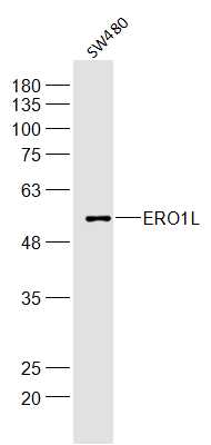SW480 lysates probed with ERO1L Polyclonal Antibody, Unconjugated (bs-10551R) at 1:300 dilution and 4°C overnight incubation. Followed by conjugated secondary antibody incubation at 1:10000 for 60 min at 37°C.