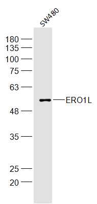 SW480 lysates probed with ERO1L Polyclonal Antibody, Unconjugated (bs-10551R) at 1:300 dilution and 4˚C overnight incubation. Followed by conjugated secondary antibody incubation at 1:10000 for 60 min at 37˚C.