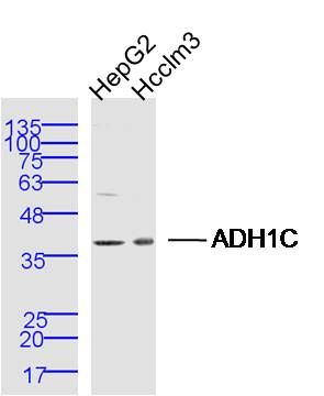 Lane 1: Hepg2 lysates; Lane 2: Hcclm3 lysates probed with ADH1C Polyclonal Antibody, Unconjugated (bs-10592R) at 1:300 dilution and 4˚C overnight incubation. Followed by conjugated secondary antibody incubation at 1:10000 for 60 min at 37˚C.