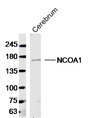 Mouse cerebrum lysates probed with NCOA1 Polyclonal Antibody, Unconjugated (bs-10603R) at 1:300 dilution and 4˚C overnight incubation. Followed by conjugated secondary antibody incubation at 1:10000 for 60 min at 37˚C. Mouse cerebrum lysates probed with NCOA1 Polyclonal Antibody, Unconjugated (bs-10603R) at 1:300 dilution and 4˚C overnight incubation. Followed by conjugated secondary antibody incubation at 1:10000 for 60 min at 37˚C.