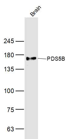 Mouse brain lysates probed with PDS5B Polyclonal Antibody, Unconjugated (bs-12605R) at 1:300 dilution and 4˚C overnight incubation. Followed by conjugated secondary antibody incubation at 1:10000 for 60 min at 37˚C.