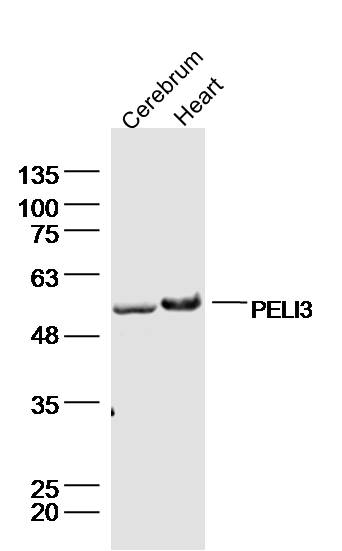 Lane 1: mouse cerebrum lysates; Lane 2: mouse heart lysates probed with PELI3 Polyclonal Antibody, Unconjugated (bs-12613R) at 1:300 dilution and 4˚C overnight incubation. Followed by conjugated secondary antibody incubation at 1:10000 for 60 min at 37˚C.