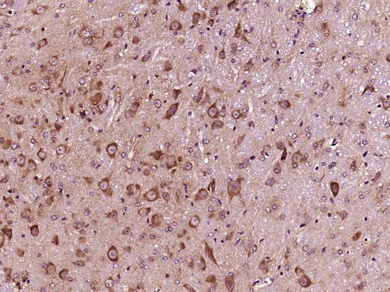 Paraformaldehyde-fixed, paraffin embedded Mouse brain; Antigen retrieval by boiling in sodium citrate buffer (pH6.0) for 15min; Block endogenous peroxidase by 3% hydrogen peroxide for 20 minutes; Blocking buffer (normal goat serum) at 37°C for 30min; Antibody incubation with IKB alpha (Ser36) Polyclonal Antibody, Unconjugated (bs-18129R) at 1:400 overnight at 4°C, DAB staining.