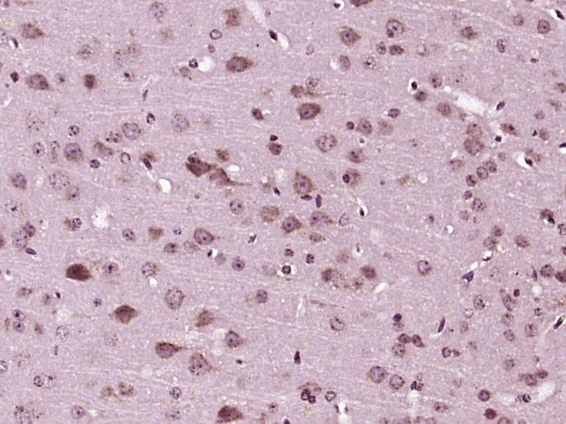 Paraformaldehyde-fixed, paraffin embedded Mouse brain; Antigen retrieval by boiling in sodium citrate buffer (pH6.0) for 15min; Block endogenous peroxidase by 3% hydrogen peroxide for 20 minutes; Blocking buffer (normal goat serum) at 37°C for 30min; Antibody incubation with MANSC1 Polyclonal Antibody, Unconjugated (bs-18656R) at 1:400 overnight at 4°C, DAB staining.