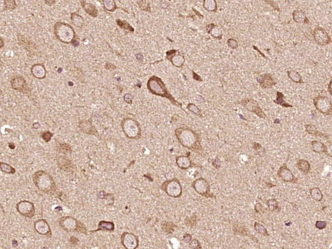Paraformaldehyde-fixed, paraffin embedded Rat brain; Antigen retrieval by boiling in sodium citrate buffer (pH6.0) for 15min; Block endogenous peroxidase by 3% hydrogen peroxide for 20 minutes; Blocking buffer (normal goat serum) at 37°C for 30min; Antibody incubation with MEX3D/RNF193 Polyclonal Antibody, Unconjugated (bs-18822R) at 1:400 overnight at 4°C, DAB staining.