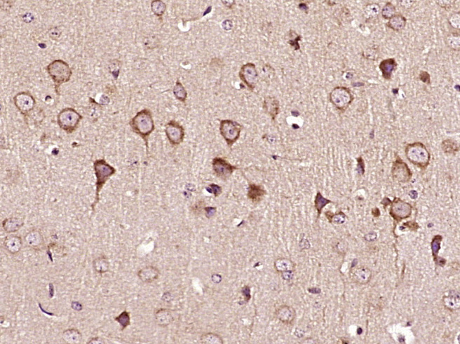 Paraformaldehyde-fixed, paraffin embedded Mouse brain; Antigen retrieval by boiling in sodium citrate buffer (pH6.0) for 15min; Block endogenous peroxidase by 3% hydrogen peroxide for 20 minutes; Blocking buffer (normal goat serum) at 37°C for 30min; Antibody incubation with MEX3D/RNF193 Polyclonal Antibody, Unconjugated (bs-18822R) at 1:400 overnight at 4°C, DAB staining.