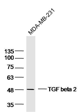 MDA-MB-231 lysates probed with TGF beta 2 Polyclonal Antibody, Unconjugated (bs-20412R) at 1:300 dilution and 4˚C overnight incubation. Followed by conjugated secondary antibody incubation at 1:10000 for 60 min at 37˚C. MDA-MB-231 lysates probed with TGF beta 2 Polyclonal Antibody, Unconjugated (bs-20412R) at 1:300 dilution and 4˚C overnight incubation. Followed by conjugated secondary antibody incubation at 1:10000 for 60 min at 37˚C.