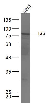 Human U251 lysates probed with Tau Polyclonal Antibody, Unconjugated (bs-20445R) at 1:300 dilution and 4˚C overnight incubation. Followed by conjugated secondary antibody incubation at 1:10000 for 60 min at 37˚C.