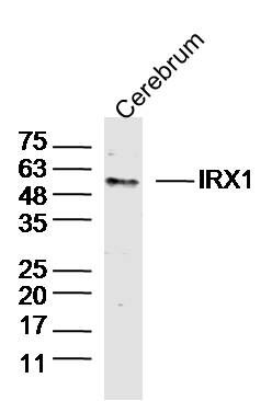 Mouse Cerebrum lysates probed with IRX1 Polyclonal Antibody, Unconjugated (bs-20469R) at 1:300 dilution and 4˚C overnight incubation. Followed by conjugated secondary antibody incubation at 1:10000 for 60 min at 37˚C.