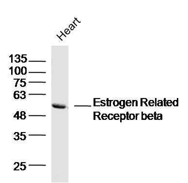 Mouse heart lysates probed with Estrogen Related Receptor beta Polyclonal Antibody, Unconjugated (bs-20471R) at 1:300 dilution and 4˚C overnight incubation. Followed by conjugated secondary antibody incubation at 1:10000 for 60 min at 37˚C.